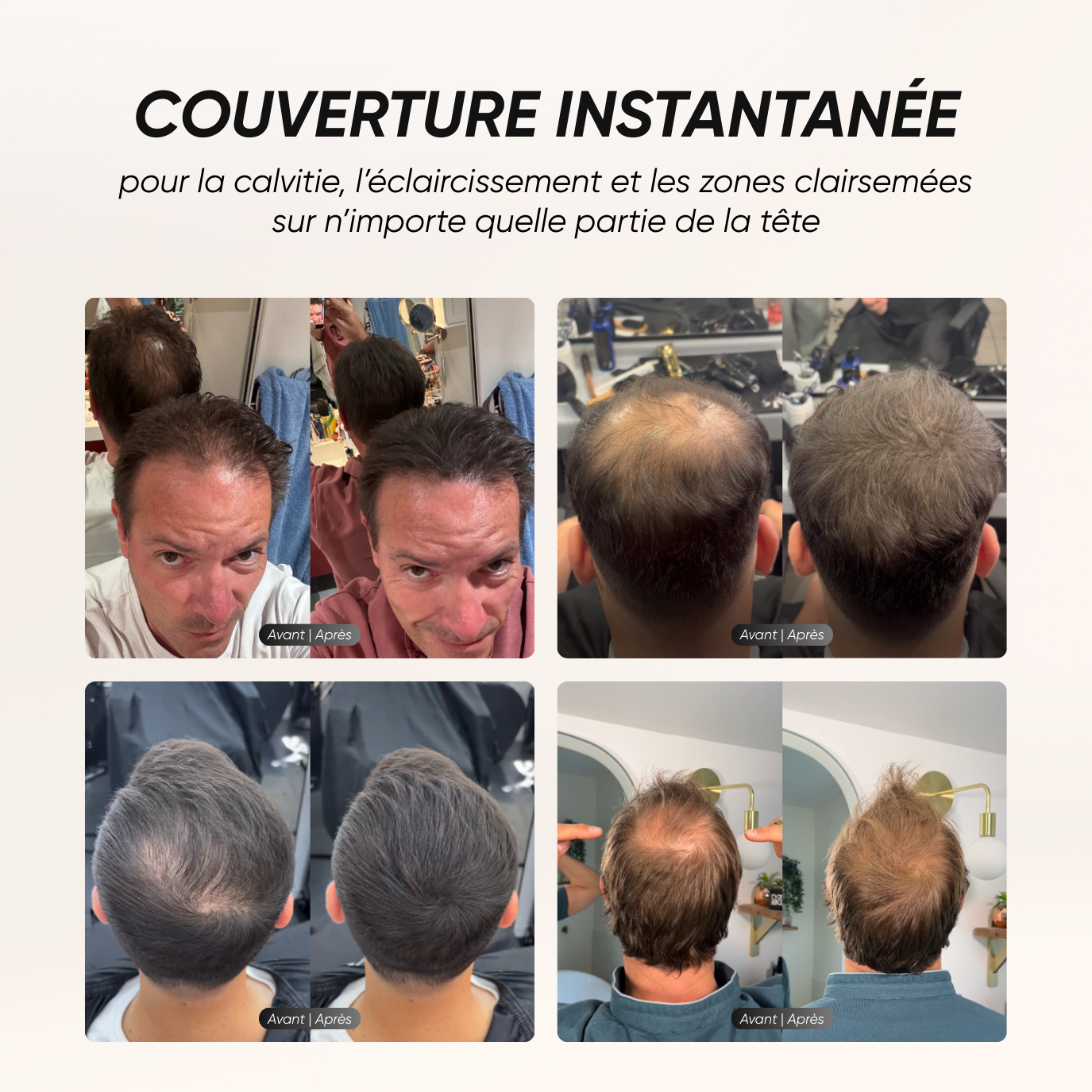 Camouflage Capillaire Instantané + Sérum Croissance Cheveux Anti-Chute Namilka