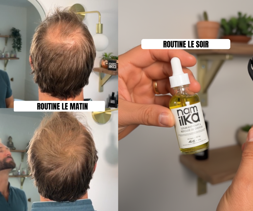 Camouflage Capillaire Instantané + Sérum Croissance Cheveux Anti-Chute Namilka