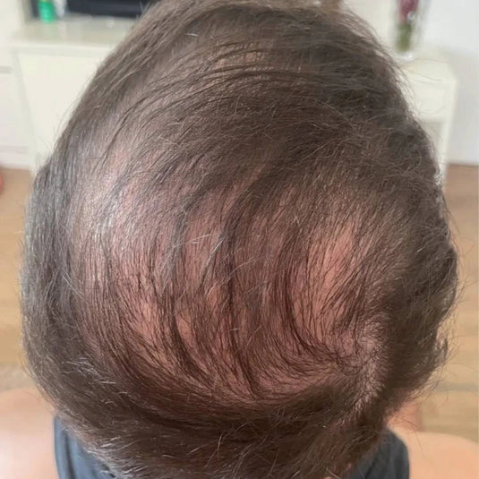 Sérum Capillaire Revitalisant Anti-Chute NamilKa pour Repousse et Cheveux Denses