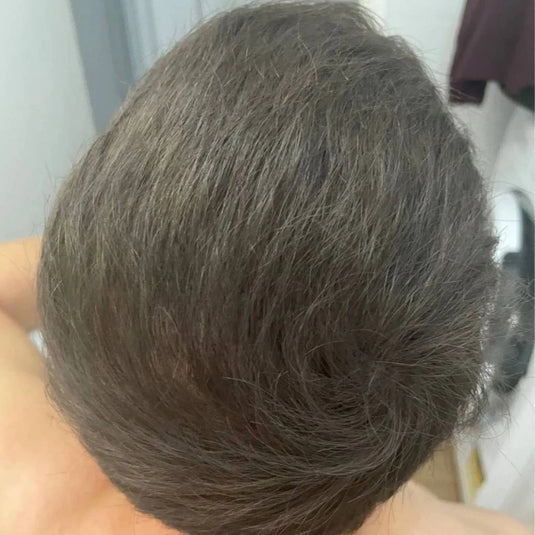 Sérum Capillaire Revitalisant Anti-Chute NamilKa pour Repousse et Cheveux Denses