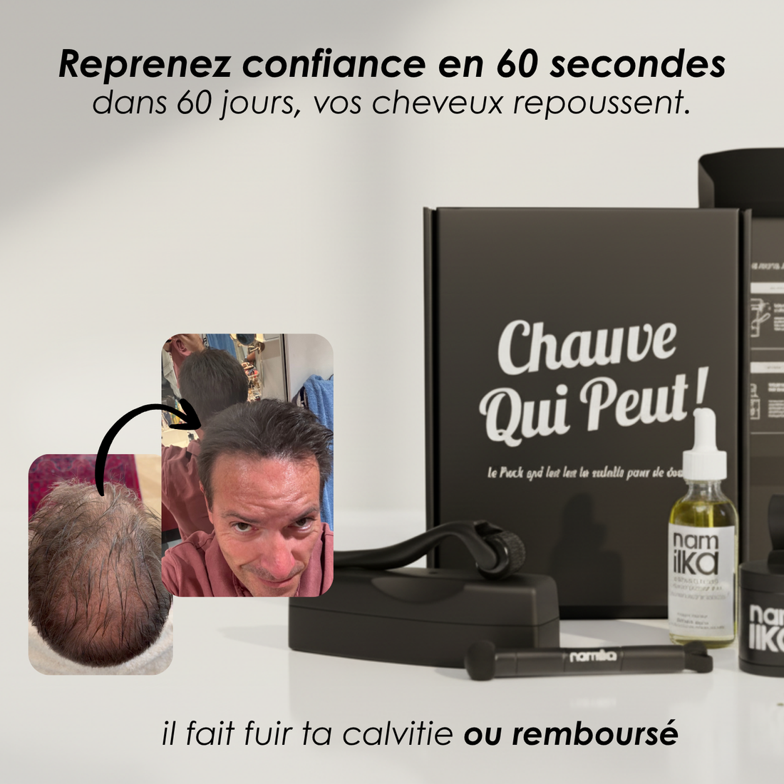 Kit de Fibres Capillaires Namilka : Volume et Épaisseur Instantanés Naturels