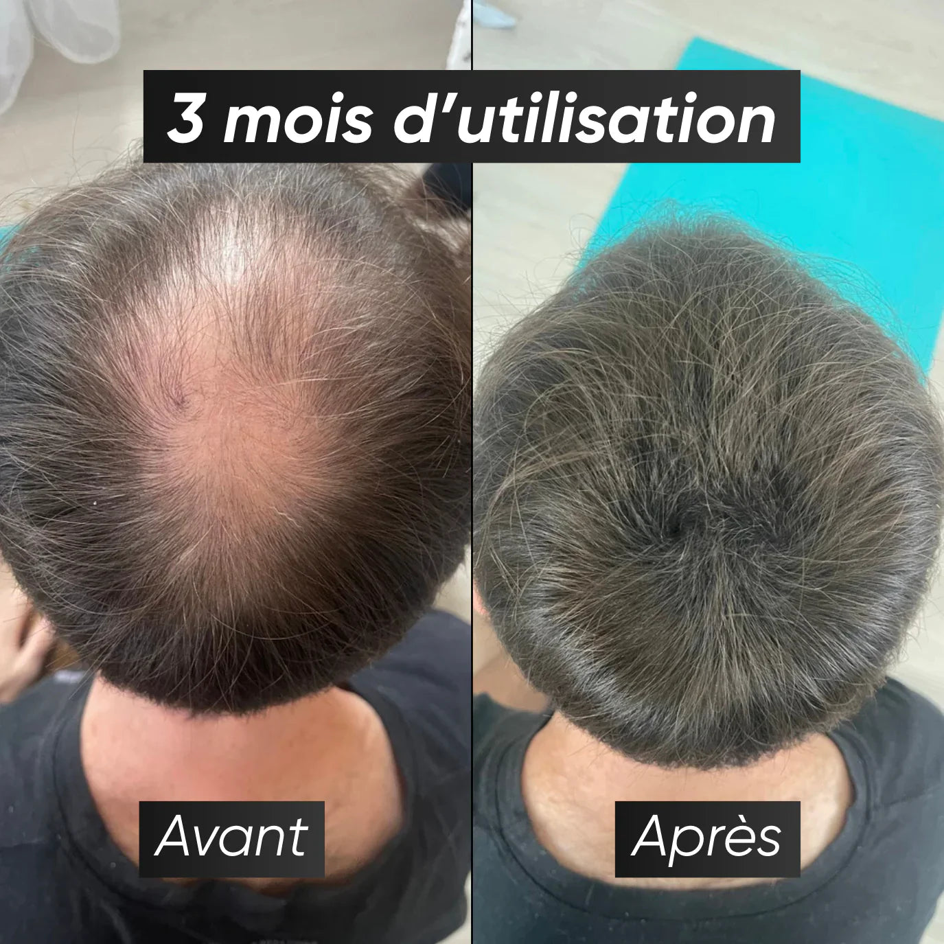 Kit de Fibres Capillaires Namilka : Volume et Épaisseur Instantanés Naturels