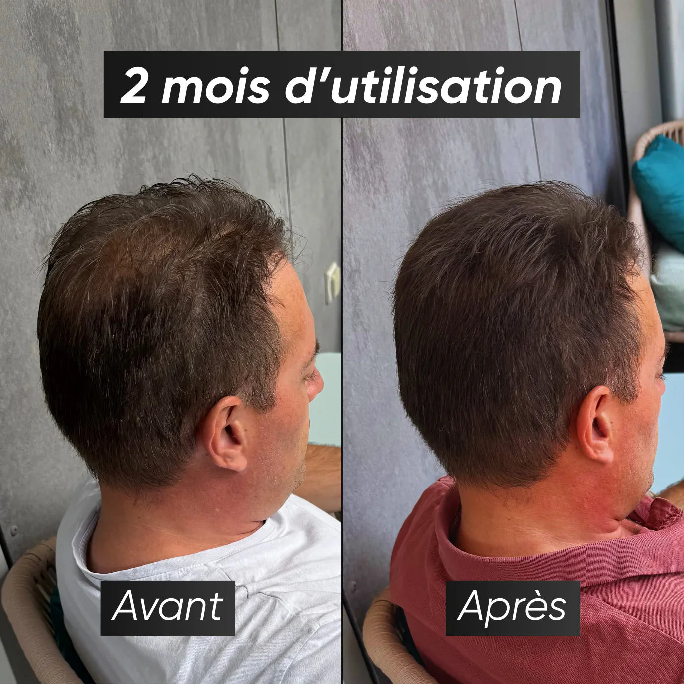 Kit de Fibres Capillaires Namilka : Volume et Épaisseur Instantanés Naturels